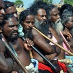 激光脫面毛的技術與應用解析